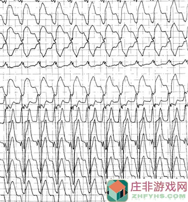 心动小镇全鸟类图鉴大公开！拍照攻略教你秒变小镇摄影大师～